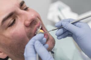 Periodontist examining a patient for gum recession and gum grafting treatment in Timonium, MD.