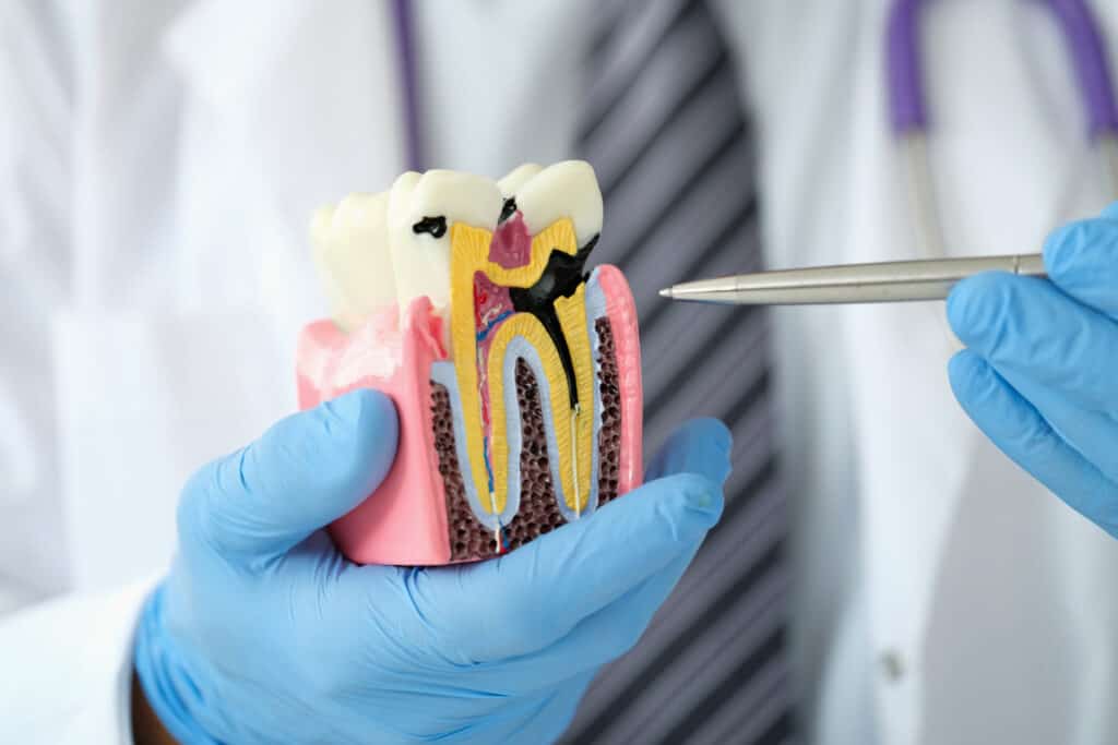 Dentist examining a detailed tooth model to explain dental bone structure and oral surgery procedures.